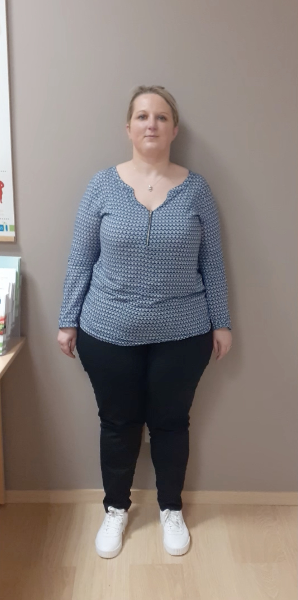 Alison avant son rééquilibrage alimentaire